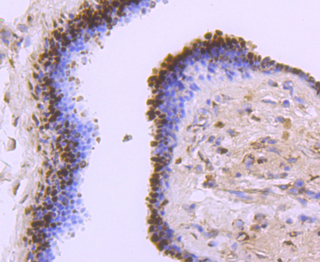 Superoxide Dismutase 1 Rabbit mAb