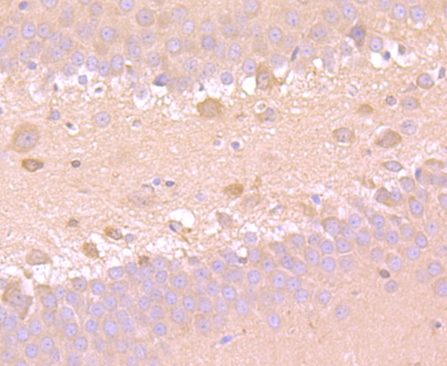 Superoxide Dismutase 1 Rabbit mAb