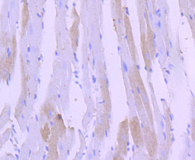 Cardiac Troponin I Rabbit mAb