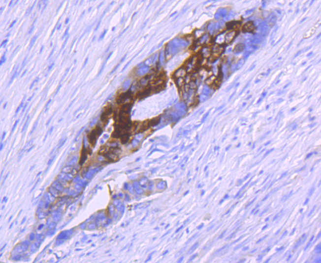 S100A10 Rabbit mAb