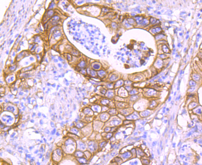 S100A10 Rabbit mAb