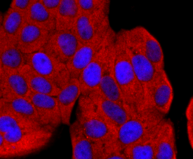 Argonaute 2 Rabbit mAb