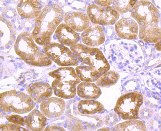 Argonaute 2 Rabbit mAb