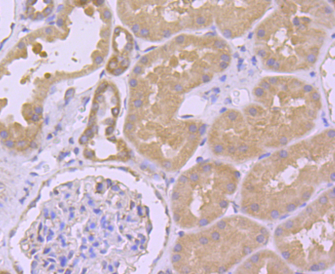 Argonaute 2 Rabbit mAb