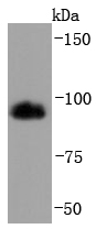 HMGCR Rabbit mAb