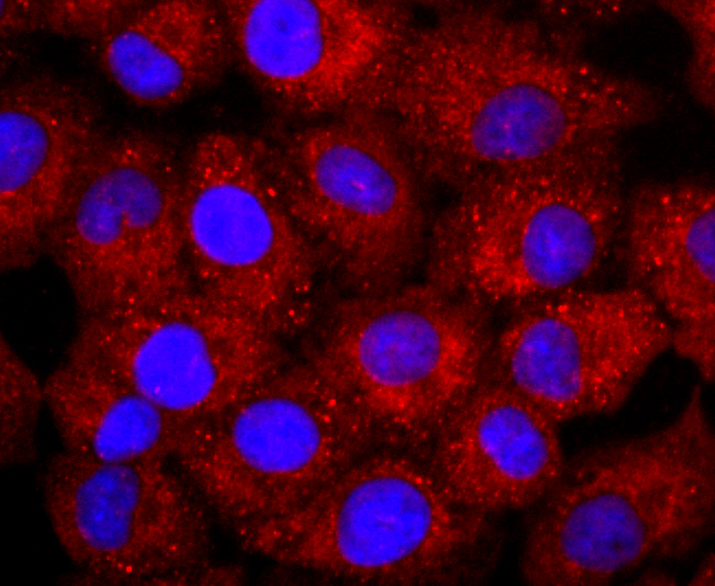 NCAM Rabbit mAb