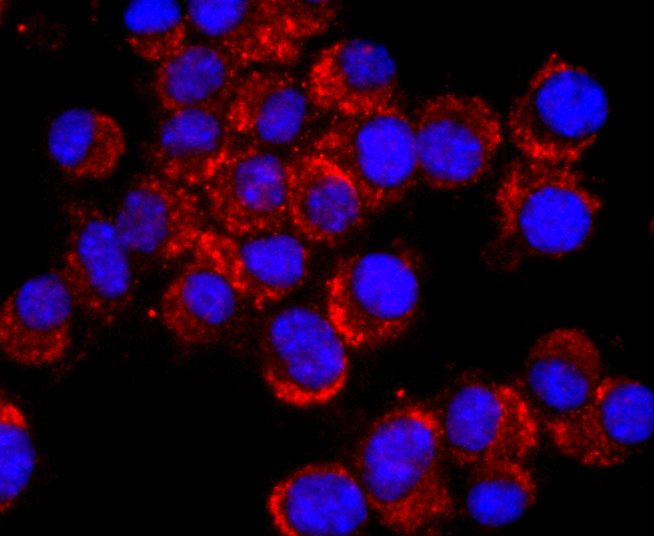 NCAM Rabbit mAb