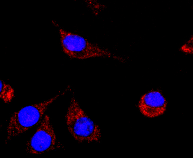 NCAM Rabbit mAb