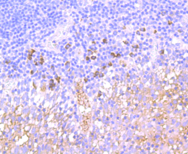 NCAM Rabbit mAb