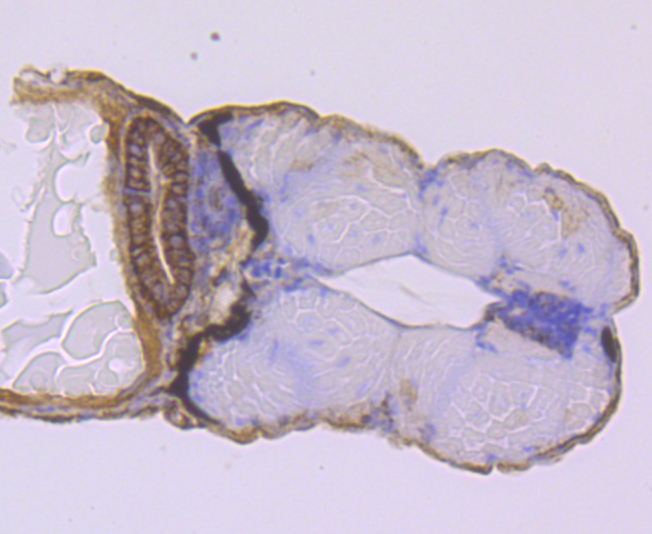 NCAM Rabbit mAb