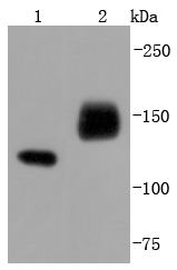 NCAM Rabbit mAb