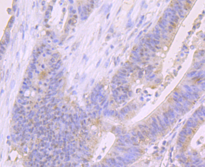 FOXP1 Rabbit mAb