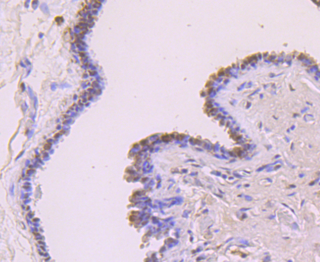 FOXP1 Rabbit mAb