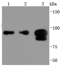 FOXP1 Rabbit mAb