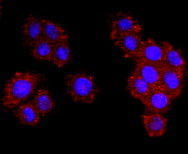 Dysferlin Rabbit mAb