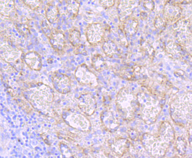 Dysferlin Rabbit mAb