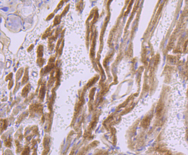 Dysferlin Rabbit mAb