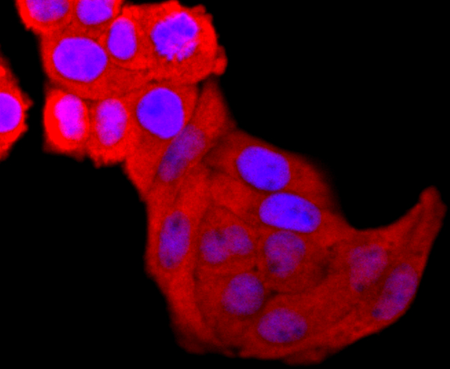 Galectin 3 Rabbit mAb