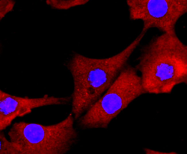 Galectin 3 Rabbit mAb