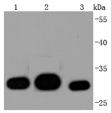 Galectin 3 Rabbit mAb