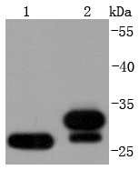 NQO1 Rabbit mAb