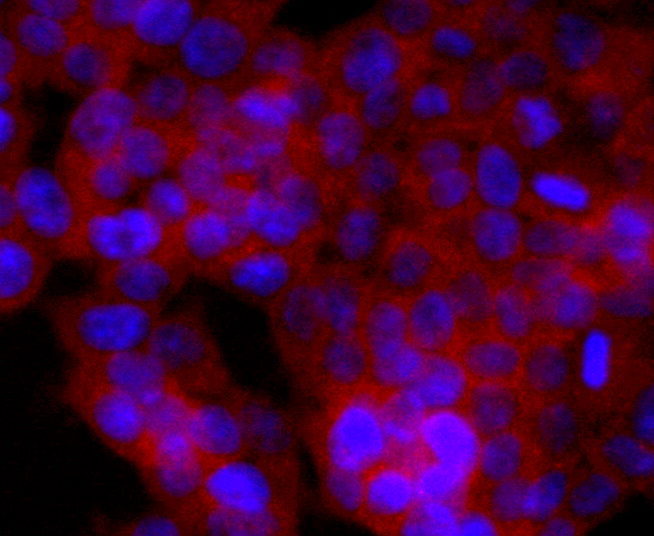 CD74 Rabbit mAb