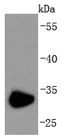 CD74 Rabbit mAb