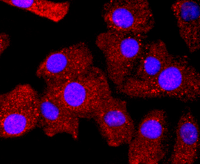 Bcl-2 Rabbit mAb