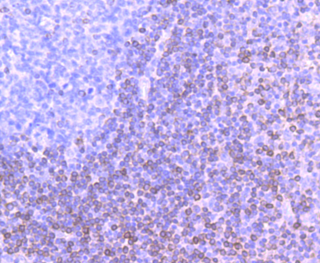 Bcl-2 Rabbit mAb