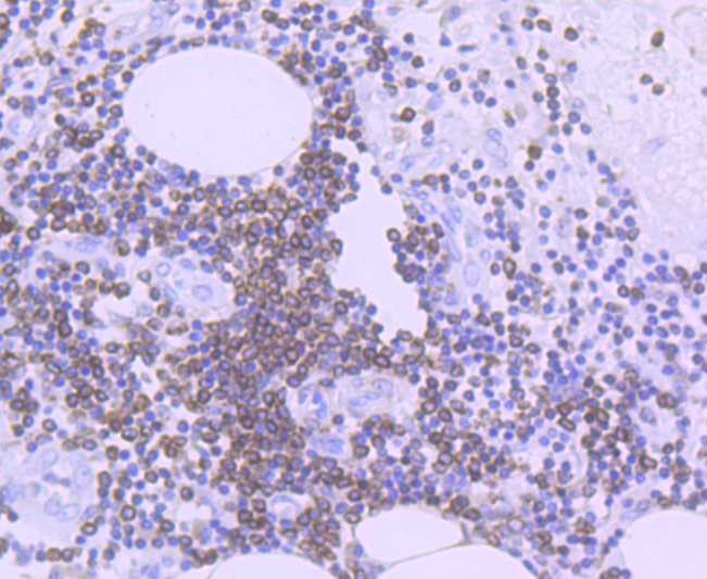 Bcl-2 Rabbit mAb