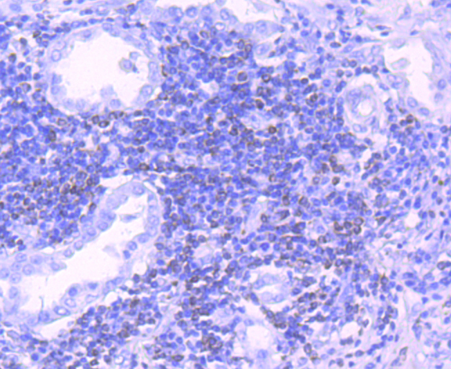 Bcl-2 Rabbit mAb