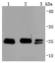 Bcl-2 Rabbit mAb