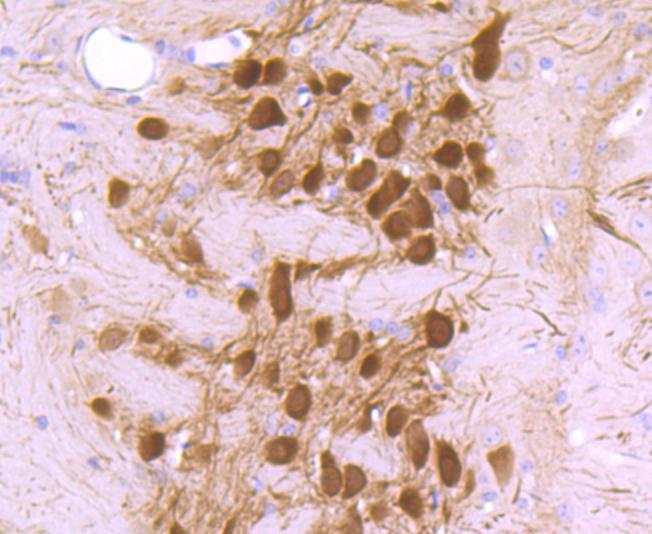 Calbindin Rabbit mAb