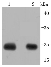 Calbindin Rabbit mAb