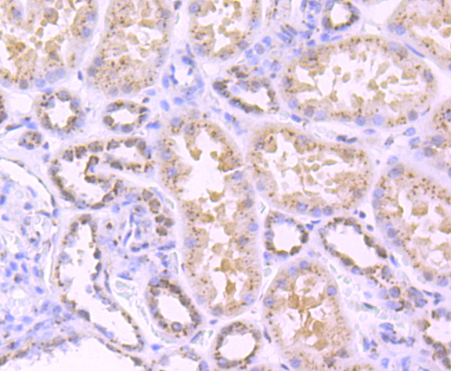 TGN46 Rabbit mAb