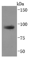 TGN46 Rabbit mAb