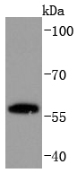 PPAR gamma Rabbit mAb