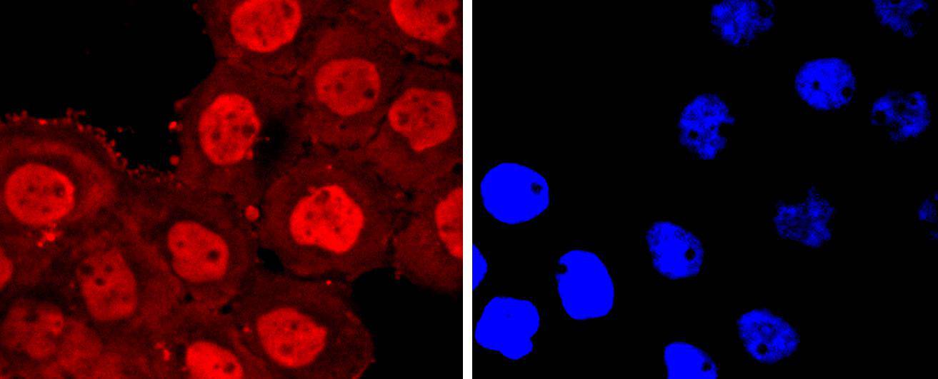 Annexin V Rabbit mAb