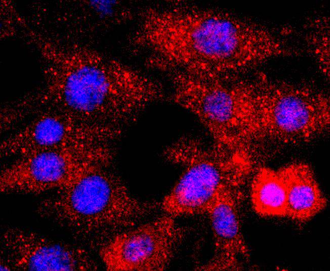 p38 MAPK Rabbit mAb