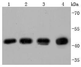 beta Actin(HRP conjugated) Rabbit mAb