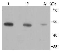 beta Tubulin(HRP conjugated) Rabbit mAb