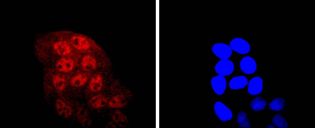 KLF4 Rabbit mAb