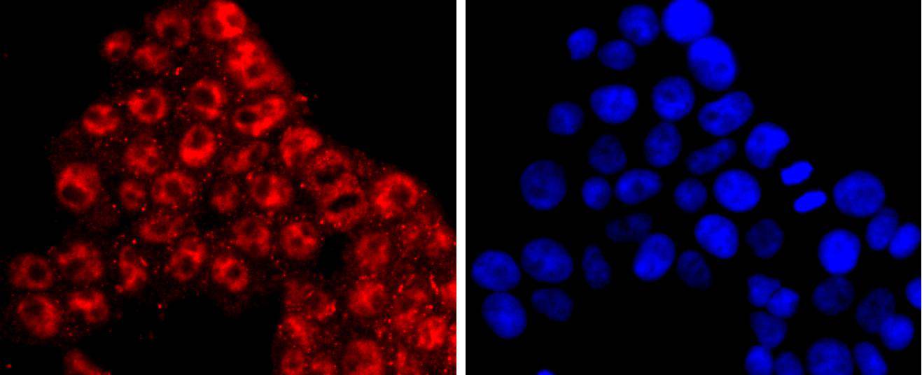 KLF4 Rabbit mAb