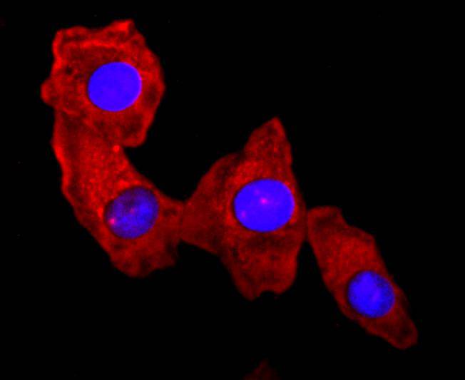 S100A9 Rabbit mAb