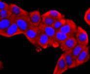 S100A9 Rabbit mAb