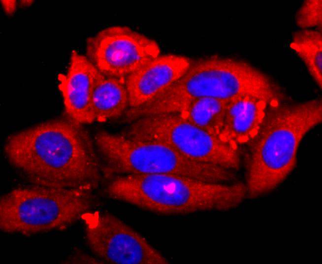 S100A9 Rabbit mAb