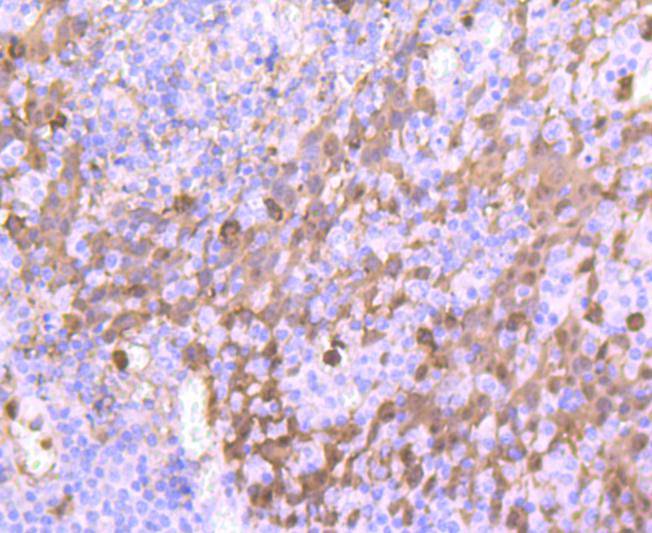 S100A9 Rabbit mAb