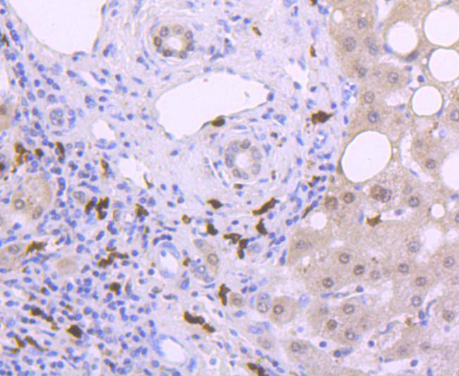 S100A9 Rabbit mAb