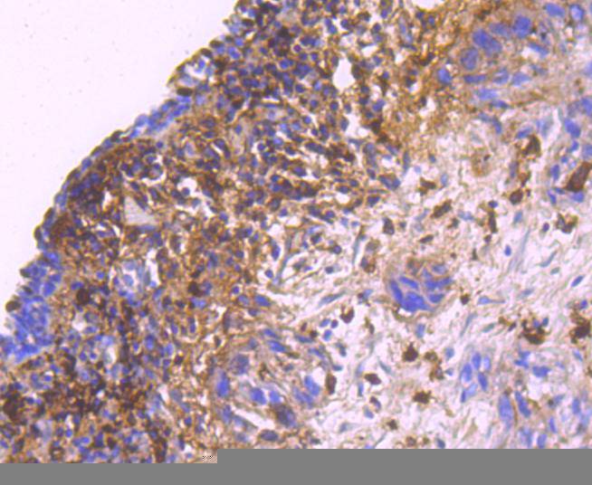 S100A9 Rabbit mAb