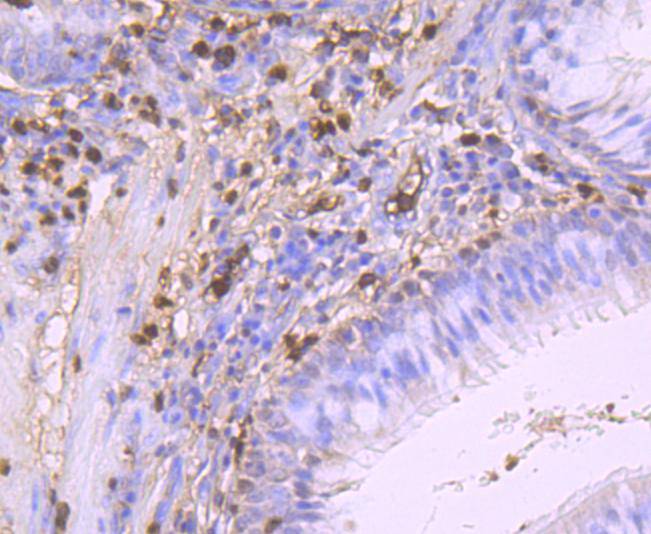 S100A9 Rabbit mAb